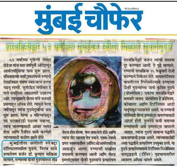 dr kunal makhija performed gold knee implant/bioloy impant surgery on women as mentioned in mumbai chaufer newspaper